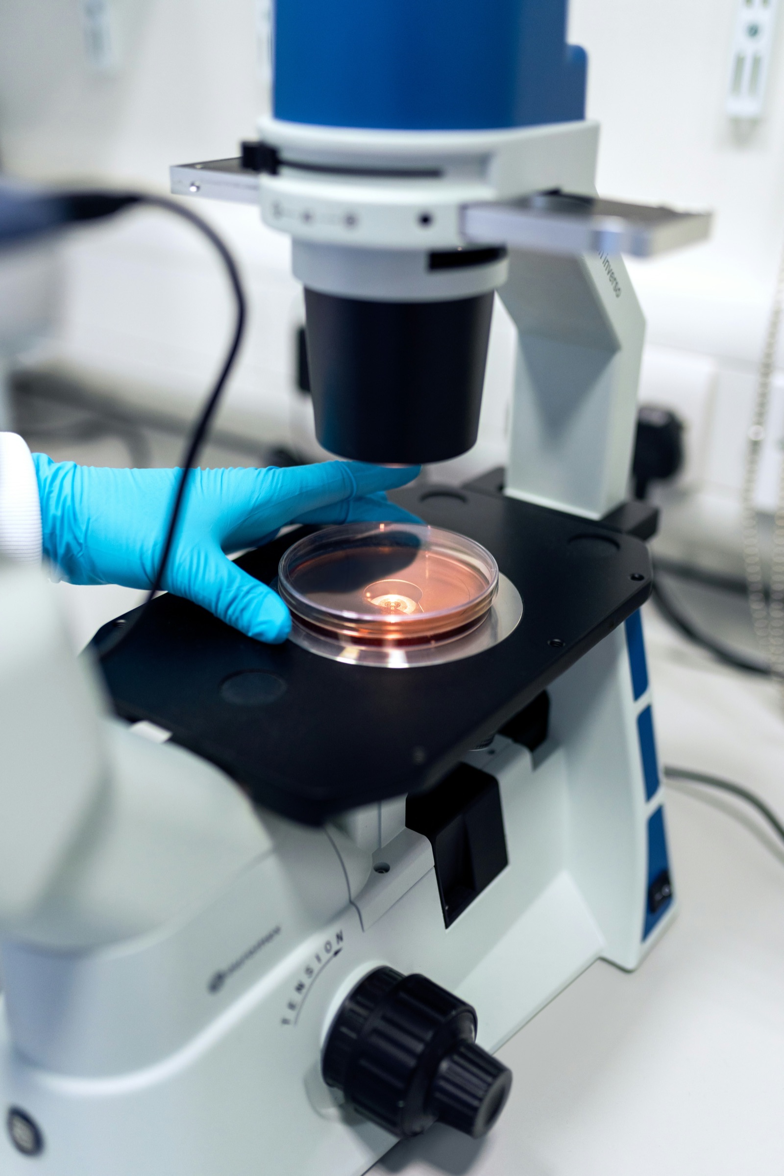 A gloved hand placing a petri dish under a laboratory microscope